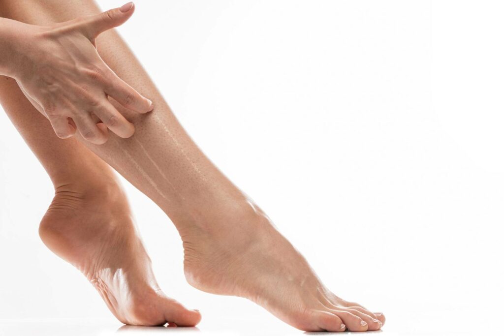 przyczyny swędzenia nóg